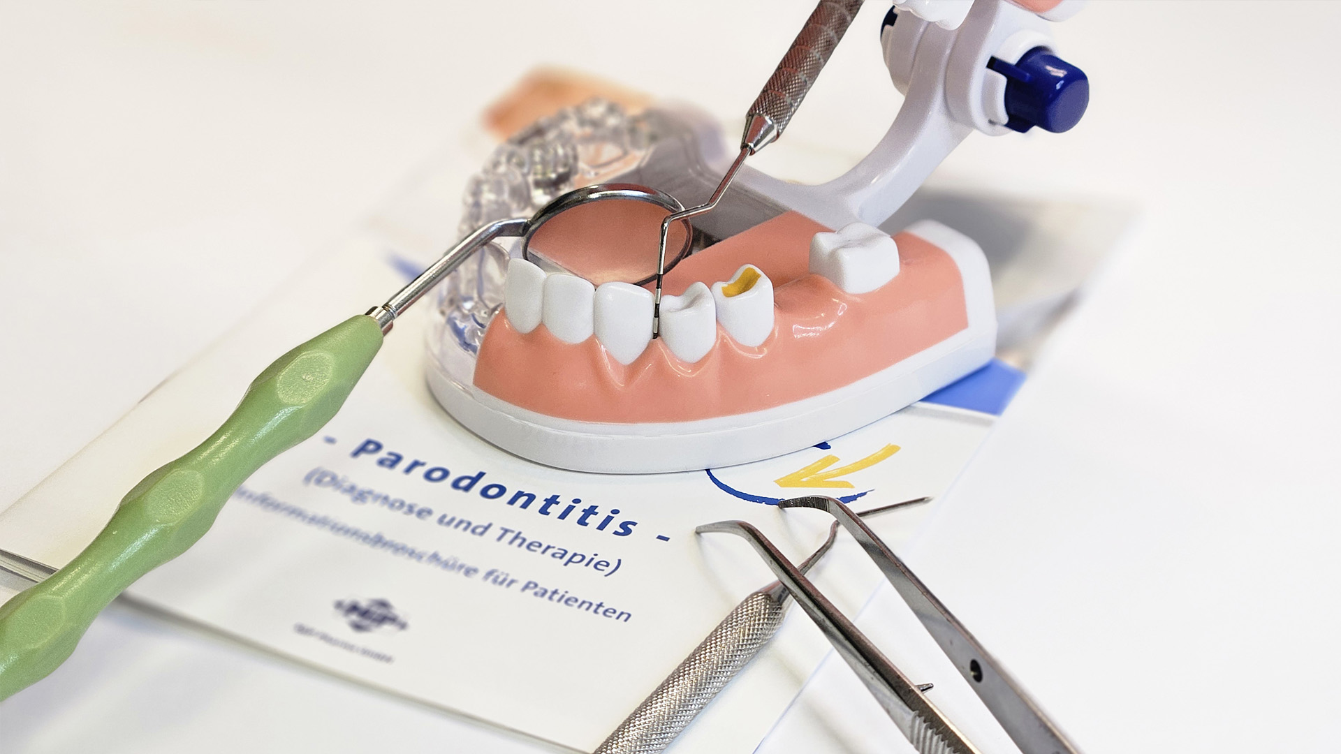 Zahnfleischerkrankung Zahnfleischerkrankung